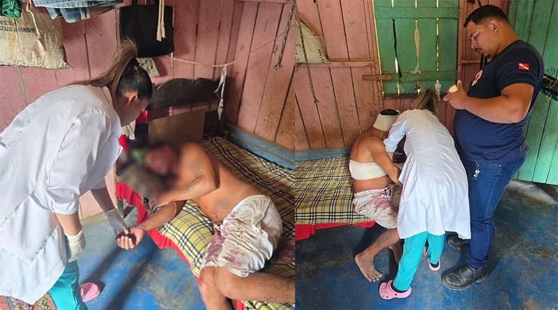 Na comunidade de Pau D’Arco do Ituqui, em Santarém um homem foi esfaqueado por vizinhos durante confusão